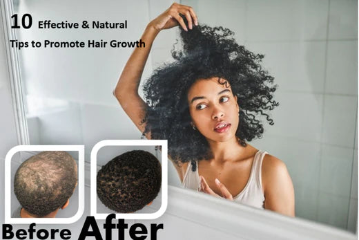 10 Effective & Natural Tips To Promote Hair Growth- For African Americans